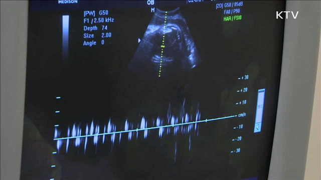 다음 달부터 '임신부 초음파 검사' 건보 적용