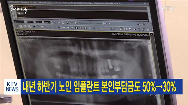 내년 하반기 노인 임플란트 본인부담금도 50%→30%