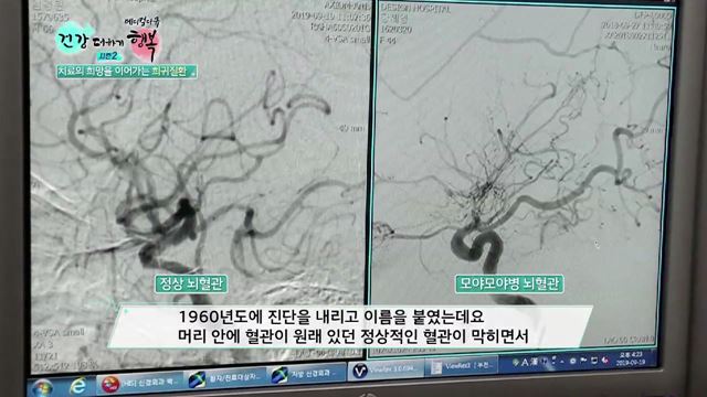 7회 하이라이트 - 치료의 희망을 이어가는 희귀질환