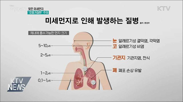 잦은 미세먼지···환절기 &#39;호흡기질환&#39; 주의