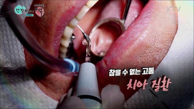 참을 수 없는 고통, 치아 질환