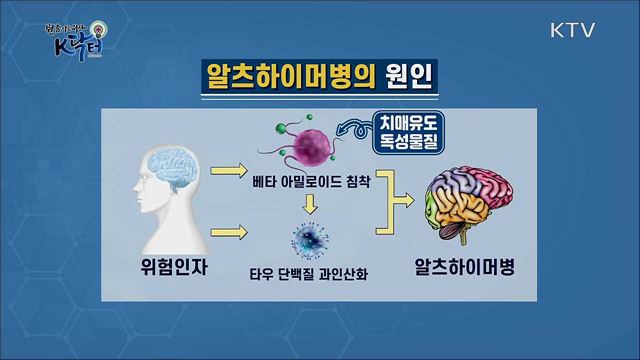 나는 치매에 걸릴 사람일까?