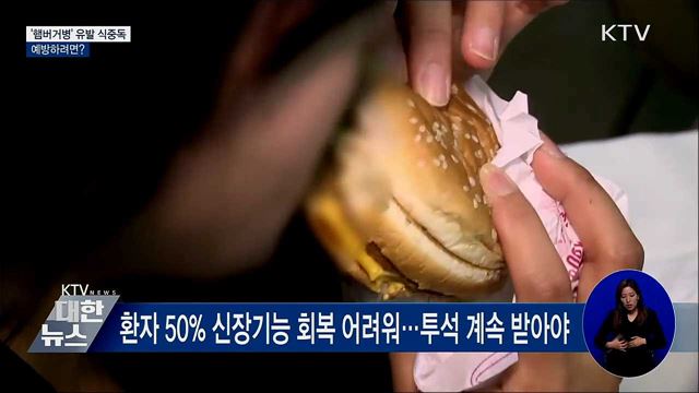 &#39;햄버거병&#39; 유발 장출혈성대장균···예방하려면?