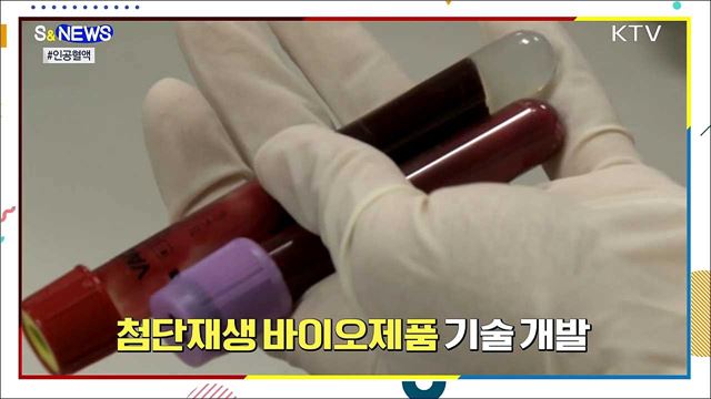 혈액 공급 체계 큰 변화 온다 [S&#38;News]