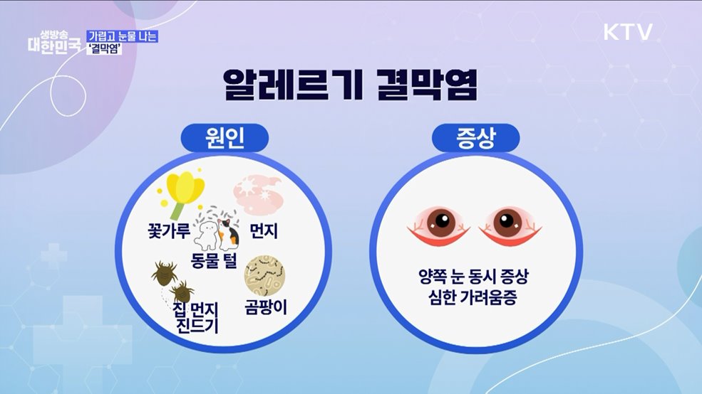 &#39;봄철 건강관리 1편&#39; 맑은 눈 되찾을 비법은? [건강 365]