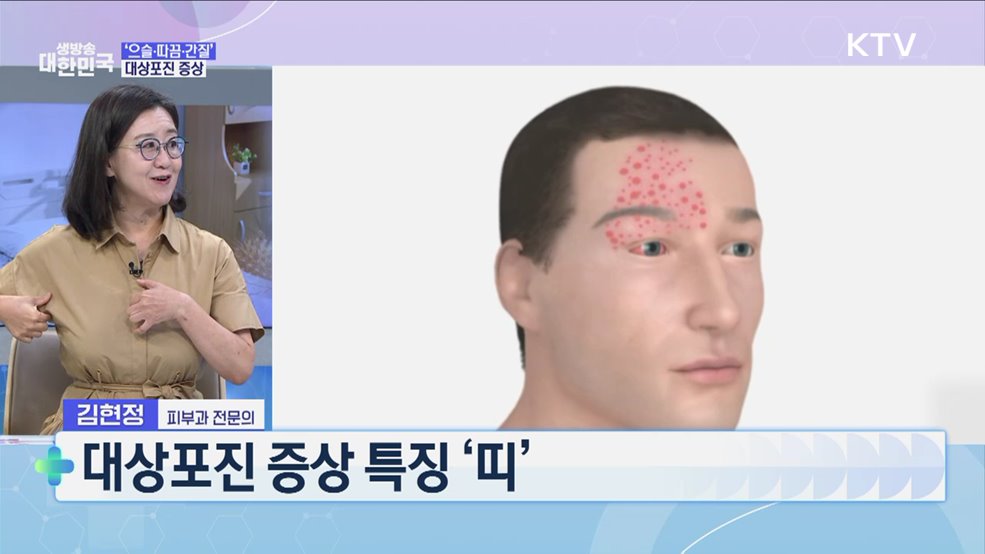 실명? 마비? 후유증이 더 무섭다···대상포진 극복·관리법 [건강 365]