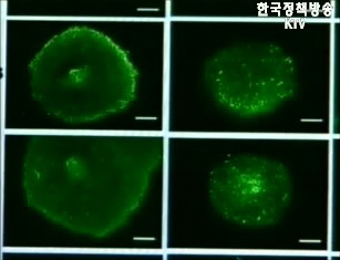 조사위, 황교수 이틀째 조사