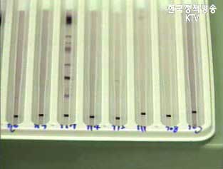지난해 에이즈 감염 하루 평균 1.9명