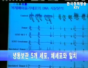 냉동보관 5개 세포, 체세포와 일치