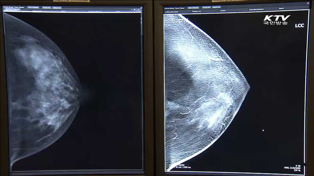 유방암 조기진단…'3차원 디지털 진단기기' 개발